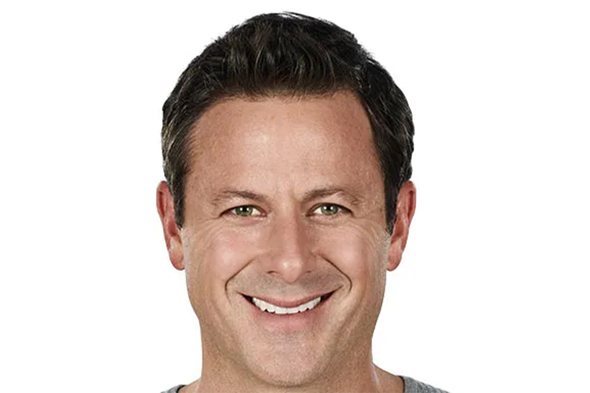 a man's smiling face before Juvederm in San Antonio