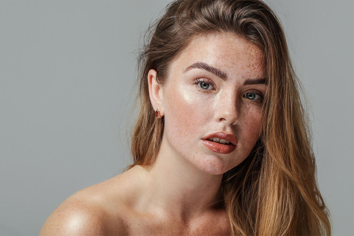a woman looking at the camera after getting laser resurfacing in San Antonio
